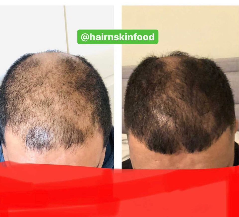 hairnskinfood.com